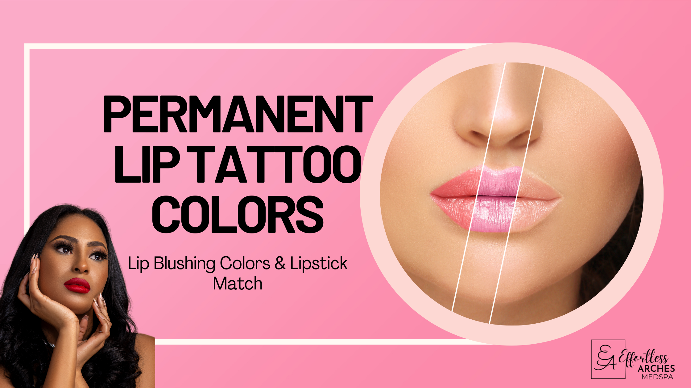 LIP TATTOOING – Skincare Laser Clinic